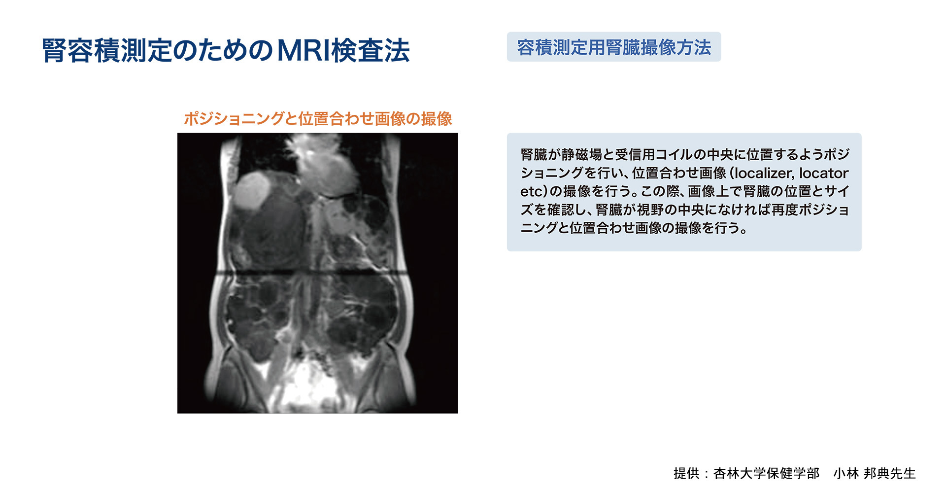 腎容積測定のためのMRI検査法