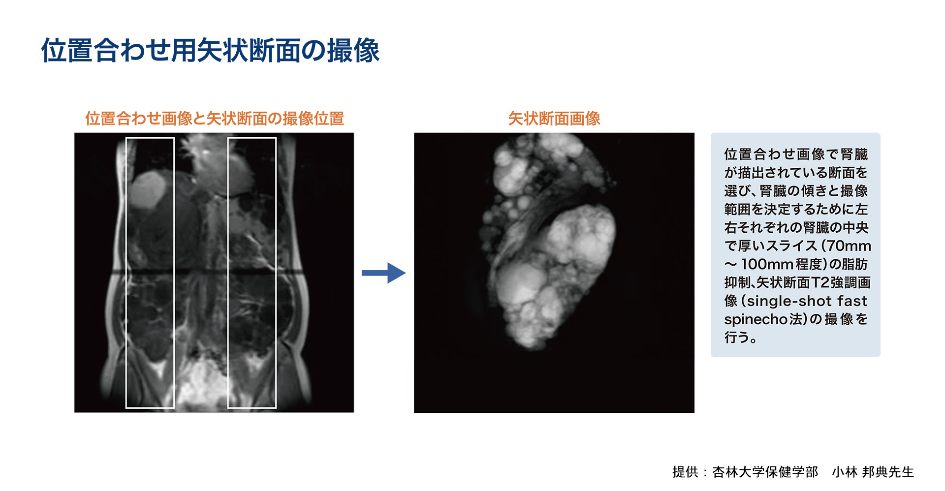 位置合わせ用矢状断面の撮像