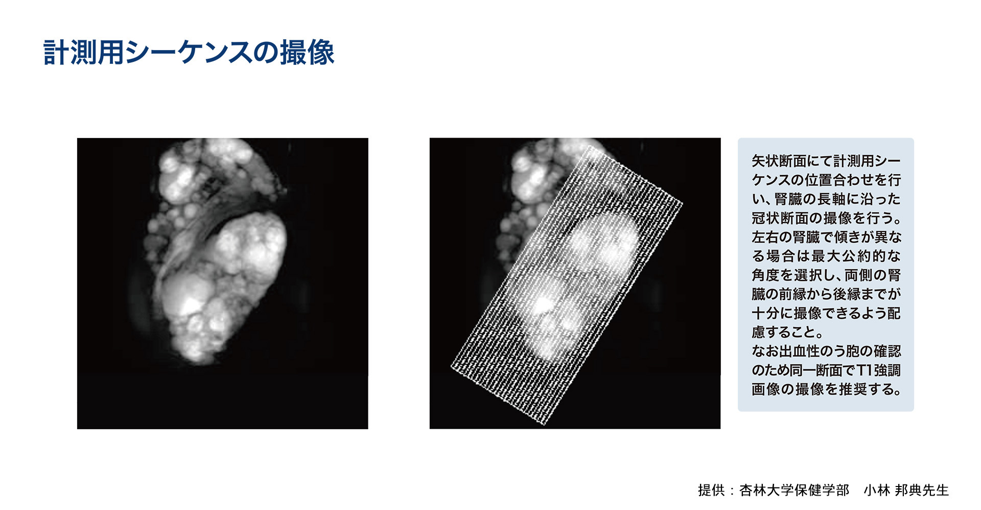 計測用シーケンスの撮像