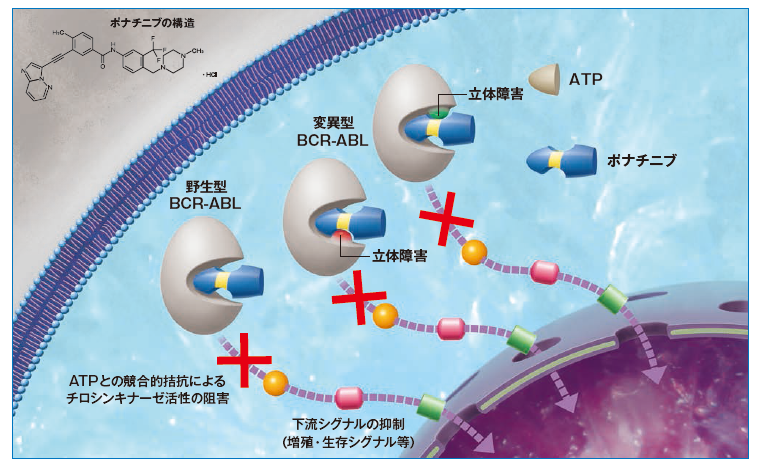 アイクルシグ錠15mg 大塚製薬 医療関係者向け情報サイト