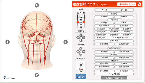 脳血管3dイラスト 大塚製薬 医療関係者向け情報サイト