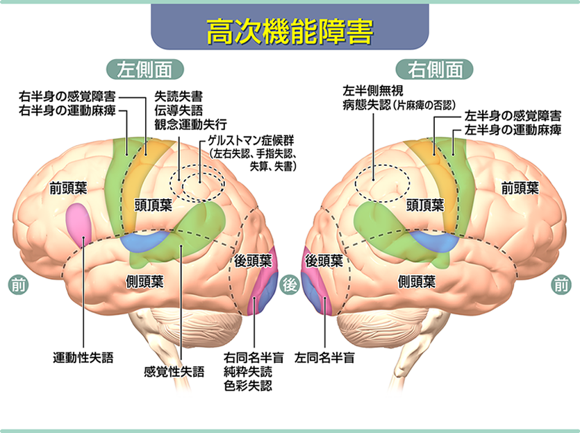 高次機能障害