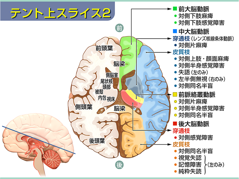 テント上スライス2
