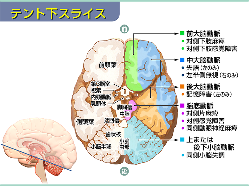 テント下スライス